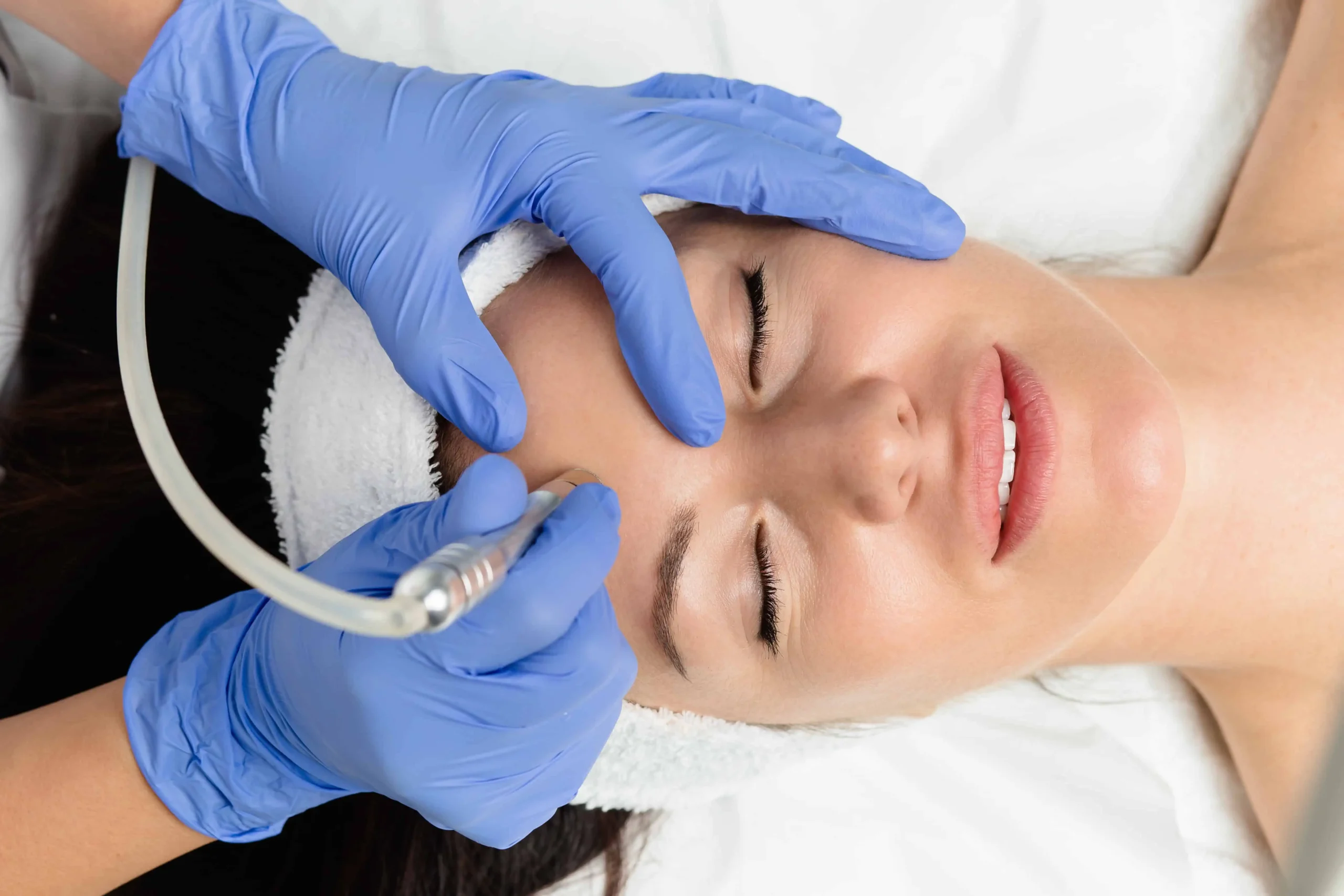 Microdermabrasion-in-Murrieta-CA