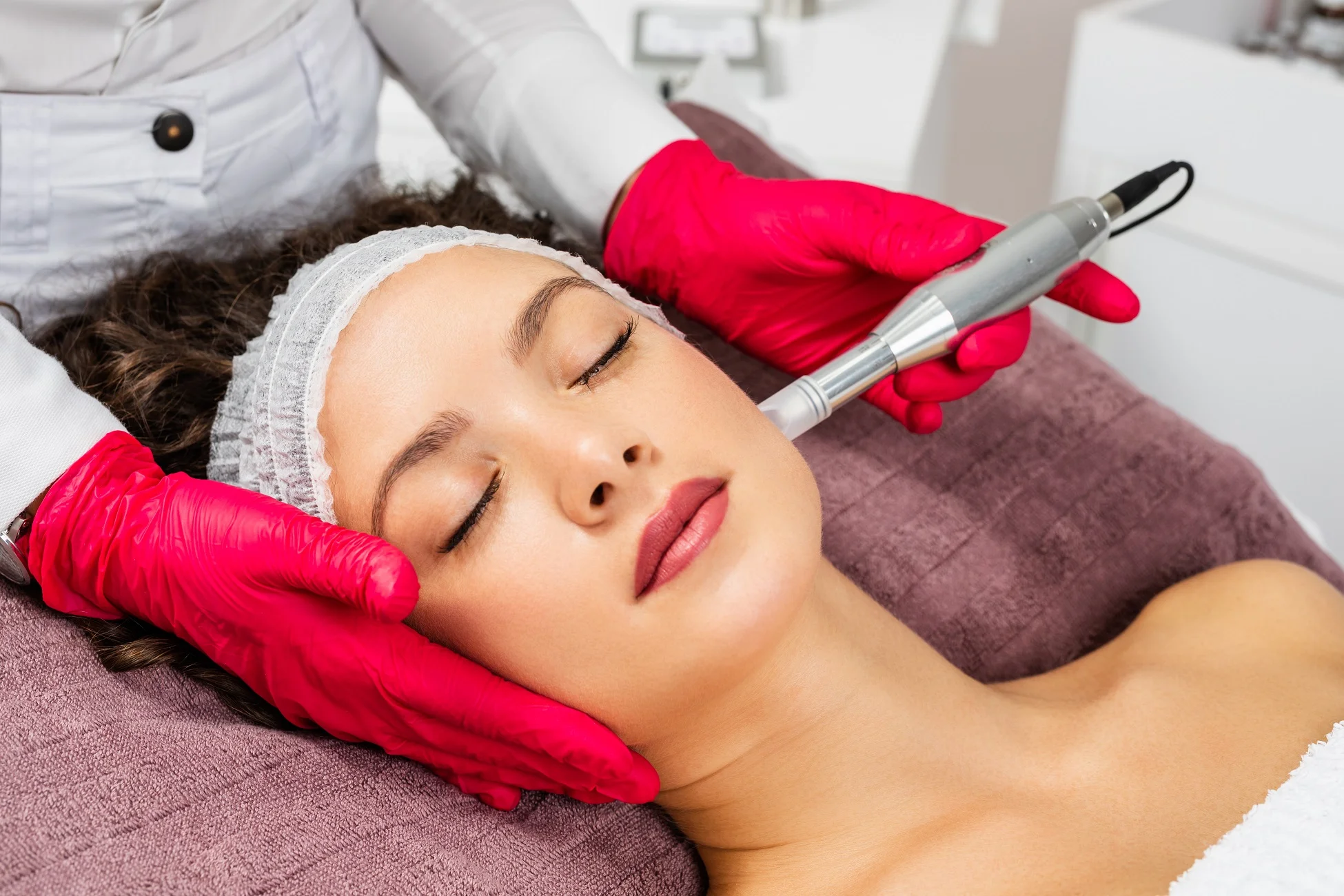 Microneedling in Murrieta